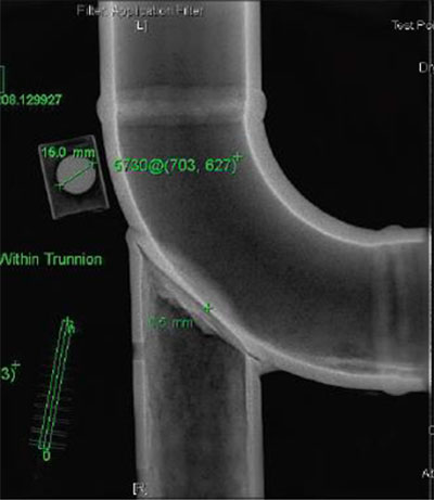 Radiograph of trunnion (Courtesy of ESR Technology)