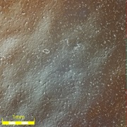 Graffi sulla superficie ed effetto 'buccia d'arancia' mediante DIC, HDR (microscopio 69x, DSX510).