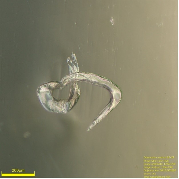 Immagini ingrandite al microscopio di residui estranei in prodotti per l'infanzia 
