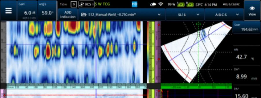 Captura de pantalla del B-scan combinado