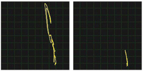 Comparison of a crack signal to a defect-free area using a weld probe